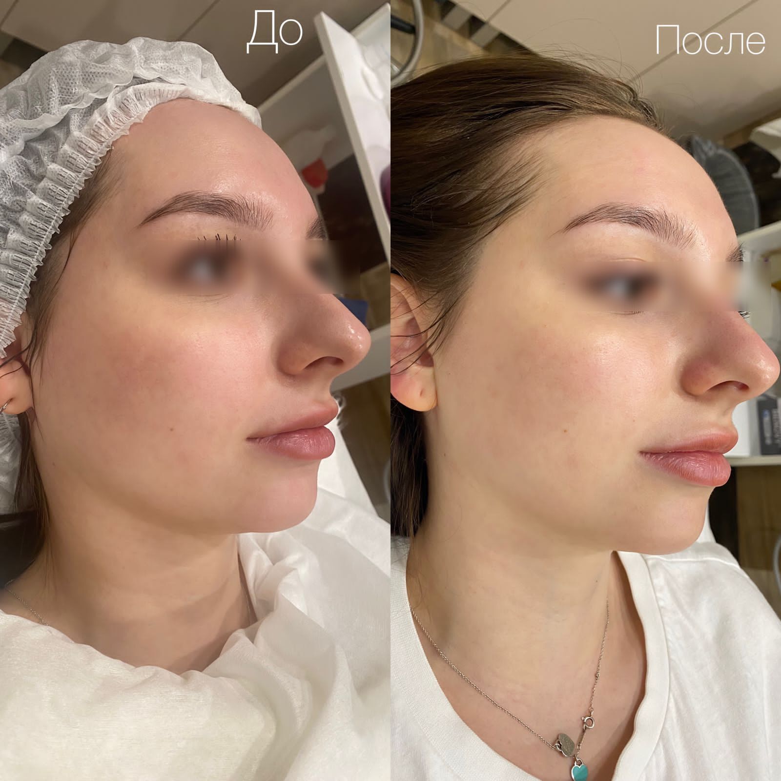 Пилинг Green Peel 1